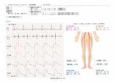 動脈硬化検査表