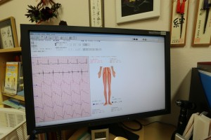 動脈硬化検査画面